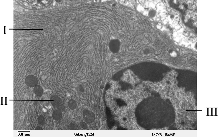 electron microscope image of part of a lung cell