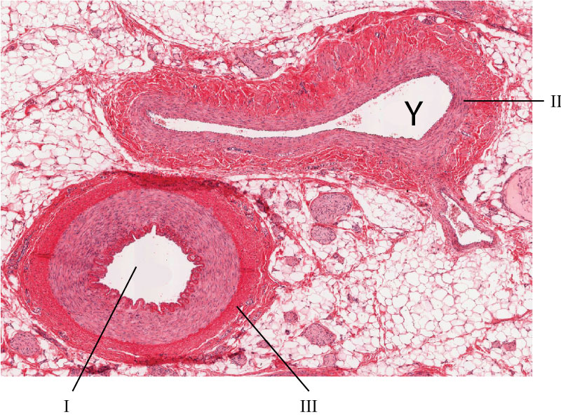 labelled image of blood vessels