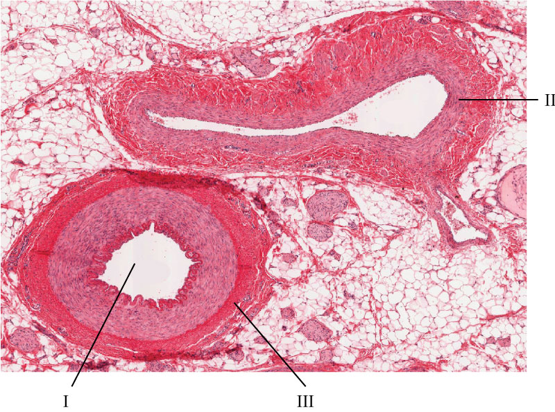 labelled image of blood vessels