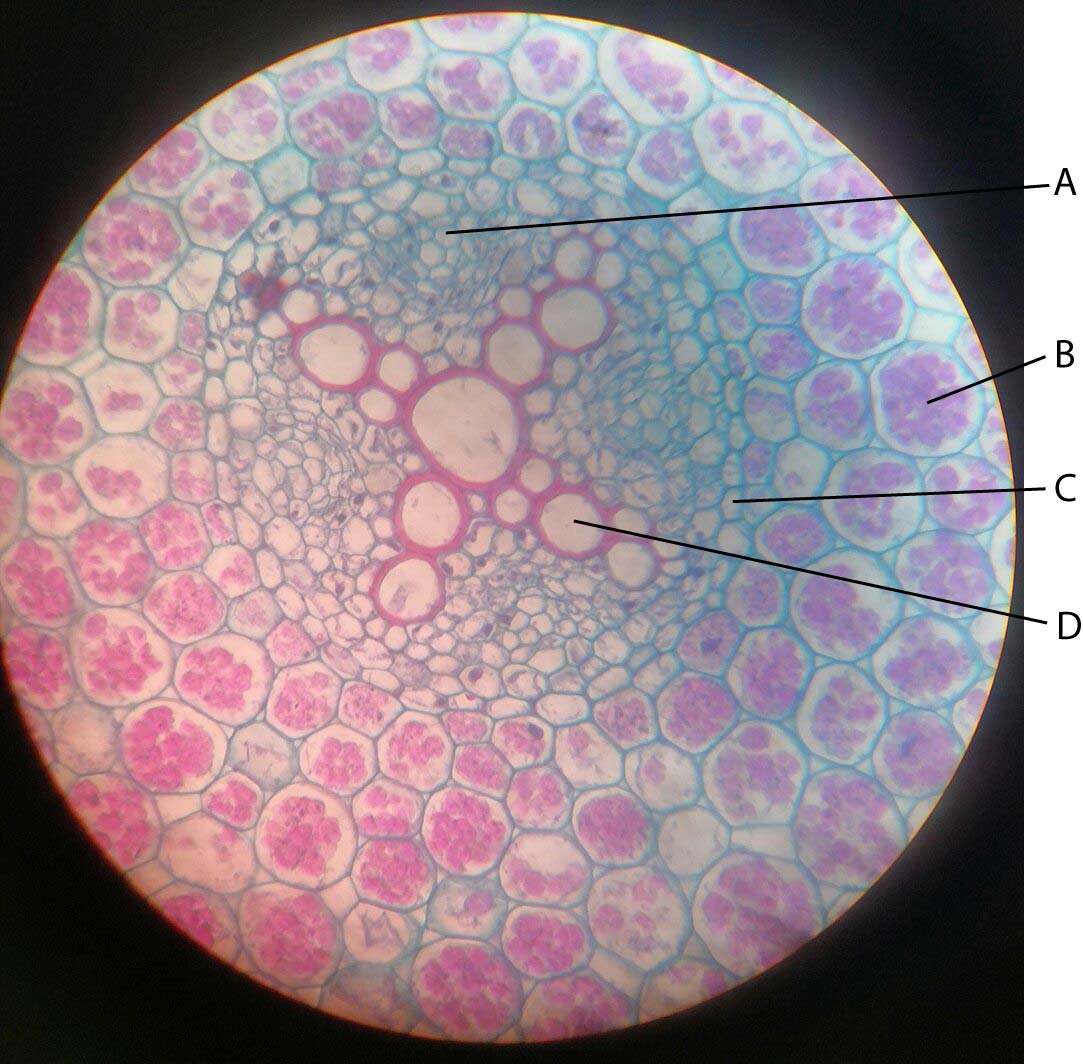 Mesophyte_leaf_Syringia cross-section