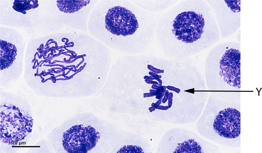 cells_in_prophase + metaphase